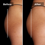 Megelin EMS Toning Shorts